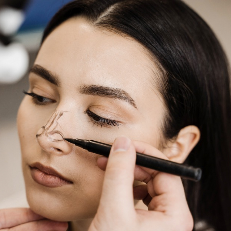Kā rinoplastika var palīdzēt elpošanas uzlabošanā?